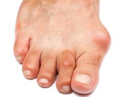 脚大拇指痛是什么原因